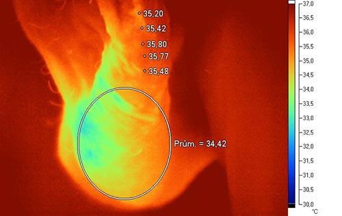 IR termografie oboustrann varikokla lev bon projekce