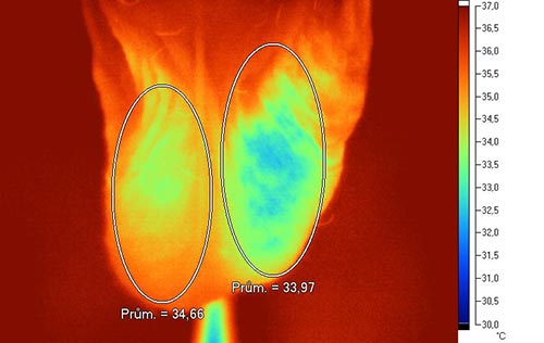 IR termografie - oboustrann varikokla eln projekce